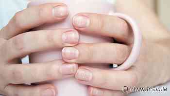 Flecke, Rillen, Wölbungen: Fingernägel verraten viel über die Gesundheit