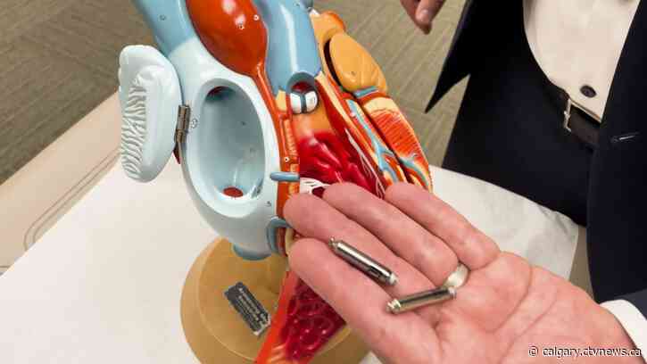 Alberta man sees big benefits after receiving leading-edge pacemaker at Calgary hospital
