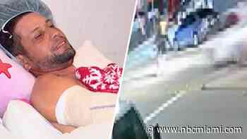 ‘People's lives are not a game': Man hit by speeding hit-and-run driver in Miami recovering