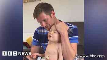 Boy with Krabbe disease defies odds and turns 10