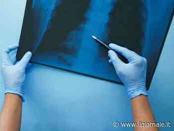 Cancro ai polmoni, 1 caso su 5 di chi si ammala è non fumatore