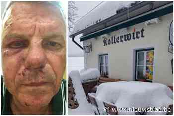 Inbrekers slaan drie keer met hamer op het hoofd van Tom (30) en vluchten met 30.000 euro: “Ze lieten mij voor dood achter”