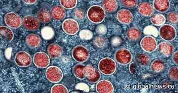Mpox in Toronto: Health officials see sharp rise in cases