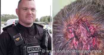 'I thought I was going to die': Police release images of officer's injuries