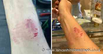 'I feared for my life' - motorist attacked in horrific road rage incident