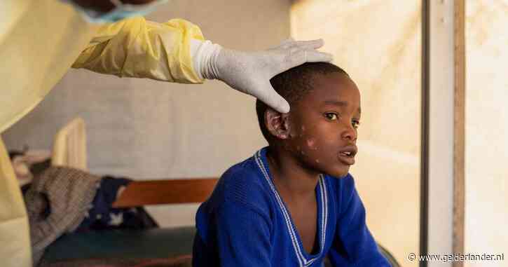 Dodelijkere variant apenpokkenvirus voor het eerst aangetroffen buiten Afrika: besmet persoon in Zweden