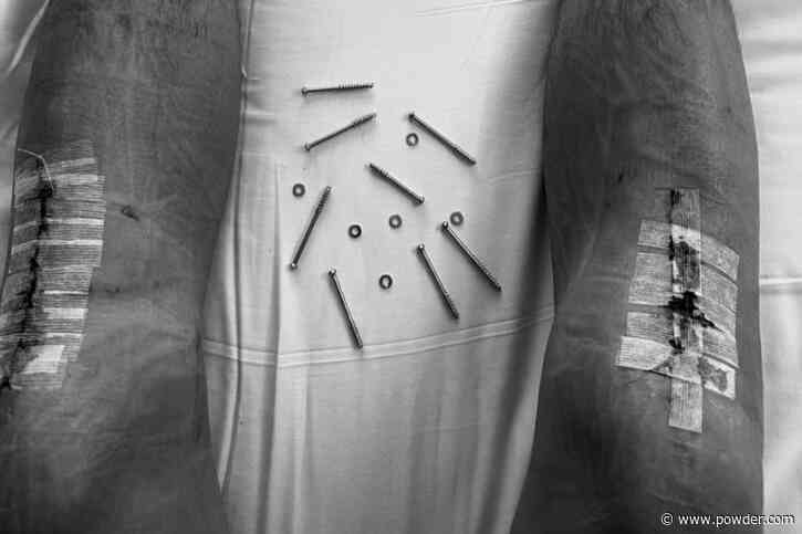 Kai Jones on Recovering From Pre-Season Surgery