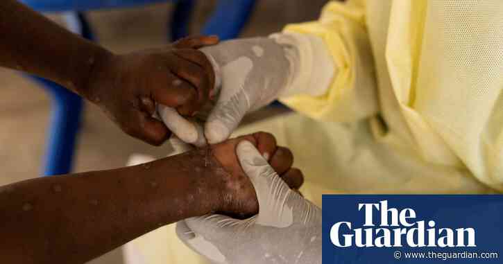 Mpox outbreak in Africa is public health emergency, declares WHO