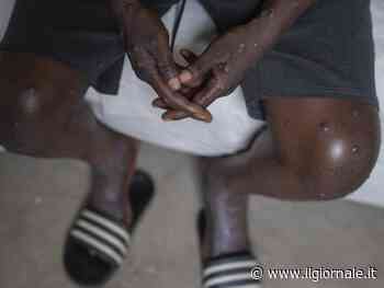 Vaiolo delle scimmie, il virus continua a mutare: ora si diffonde per via sessuale