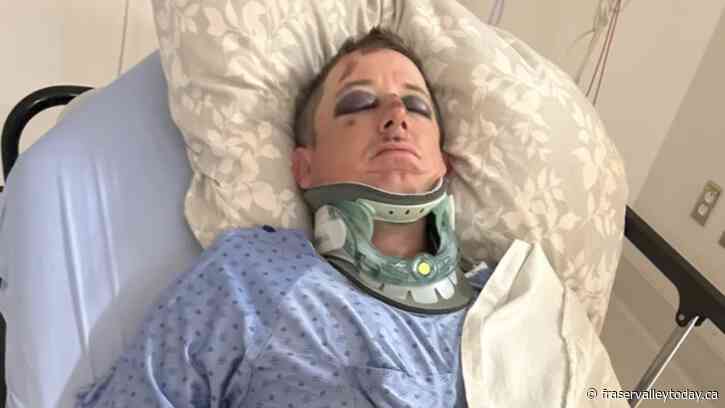 Cultus Lake firefighter critically hurt in e-scooter accident