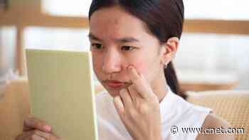 Do Pimple Patches Work? We Asked a Dermatologist