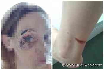 Vrouw ontvoerd en in elkaar geslagen door vriend van haar echtgenoot: “Op een vreselijke manier misbruik gemaakt van onze relatieproblemen”