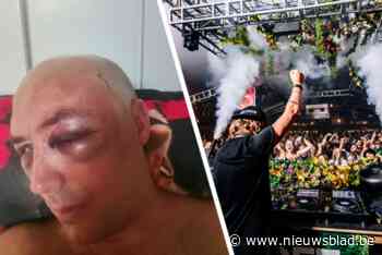 Bezoeker Berings festival belandt in ziekenhuis: “Bewusteloos geslagen door security”