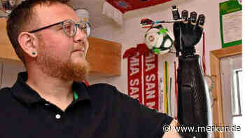 Nach 17 Jahren Schmerz-Tortur: Familienvater lässt sich Hand amputieren – und will jetzt zurück ins Leben