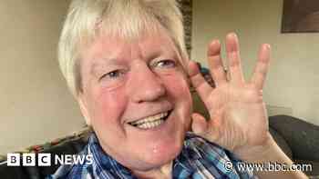 Ex-miner gets new teeth after months of waiting