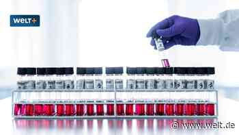 Mpox auf dem Vormarsch - und die großen Pharma-Gewinner zeichnen sich schon ab