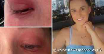 Beckenham woman's rare condition which makes her allergic to her own period