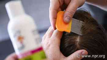Were you sent home from school for head lice? Here’s why that’s no longer recommended