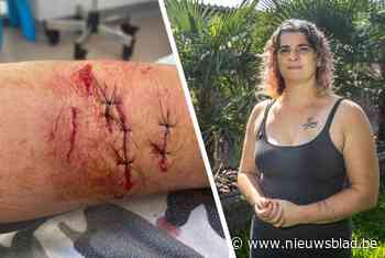 Sofie sluit dierenasiel na zwaar bijtincident: “Als ik alleen geweest was, had ik het niet kunnen navertellen”