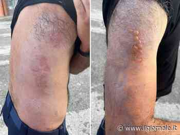 Olio bollente sugli agenti a Cuneo: ancora tumulti nelle carceri italiane