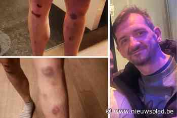 Kevin (38) wordt twee keer aangereden en loopt zware kneuzingen op: “Maar niemand is gestopt”