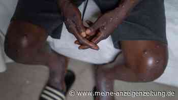 Erste Mpox-Impfdosen erreichen Hotspot in Afrika