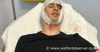 Police probe launched after teen left with ABH-level head wound