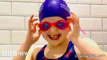 Swimmer says double vision is no barrier to success