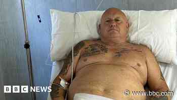 Man developed flesh-eating disease after 'bite'