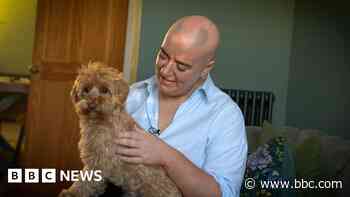 Alopecia patients given hope with new drug