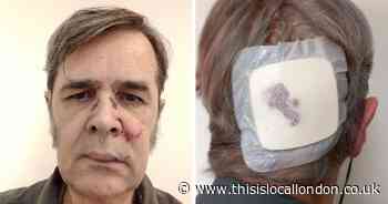 Sutton man, 73, attacked after ‘telling e-scooter rider he was riding illegally’
