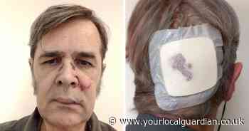 Sutton man, 73, attacked after ‘telling e-scooter rider he was riding illegally’