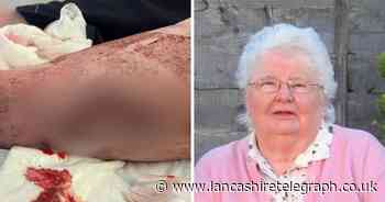 Kind stranger helped mum, 86, who was 'bleeding profusely' in street