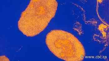 Whooping cough cases in Ontario on pace for annual record