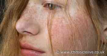 Doctor shares five signs on the skin that could mean you need to see a GP