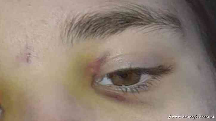 Man slaat meisje (15) in elkaar, oogkassen en borstkas gekneusd