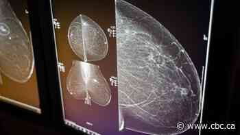 Advocates say Sask. gov't did not properly prepare to drop mammography age to 40 from 50