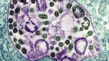 Bereits zehn Tote: Tödliches Marburg-Virus greift in Ruanda um sich