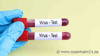 Marburg-Virus-Verdacht in Hamburg nicht bestätigt: So fatal wäre der Ausbruch der Krankheit