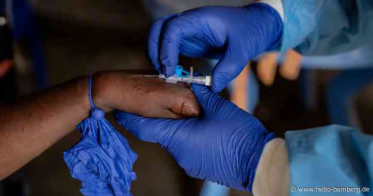 Kongo beginnt mit Mpox-Impfungen