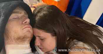 'I was sure my girlfriend would me leave after horrific accident'