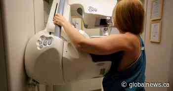 Ontario lowers mammogram self-referral age to 40 years old from 50