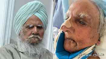 Hospital system apologizes after Brampton Sikh man's beard shaved