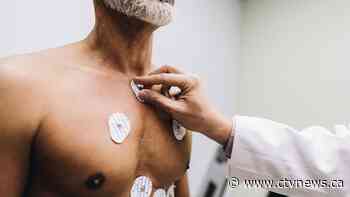 Common heart conditions raise the risk of dementia, experts say