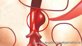 So wird ein Aneurysma behandelt