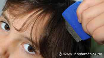 Läuse-Alarm in Schulen und Kitas: Warum die lästigen Biester jetzt so aktiv sind