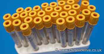 UK GPs encouraged to screen for Fragile X syndrome amid rising concerns