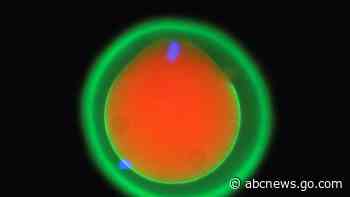 Scientists show how sperm and egg come together like a key in a lock