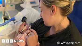 Sterilised mum: My miracle baby stopped breathing three times
