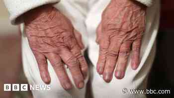 Experts hope 'repurposed' drugs may limit dementia